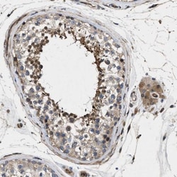 HspA12B Antibody, Novus Biologicals:Antibodies:Primary Antibodies